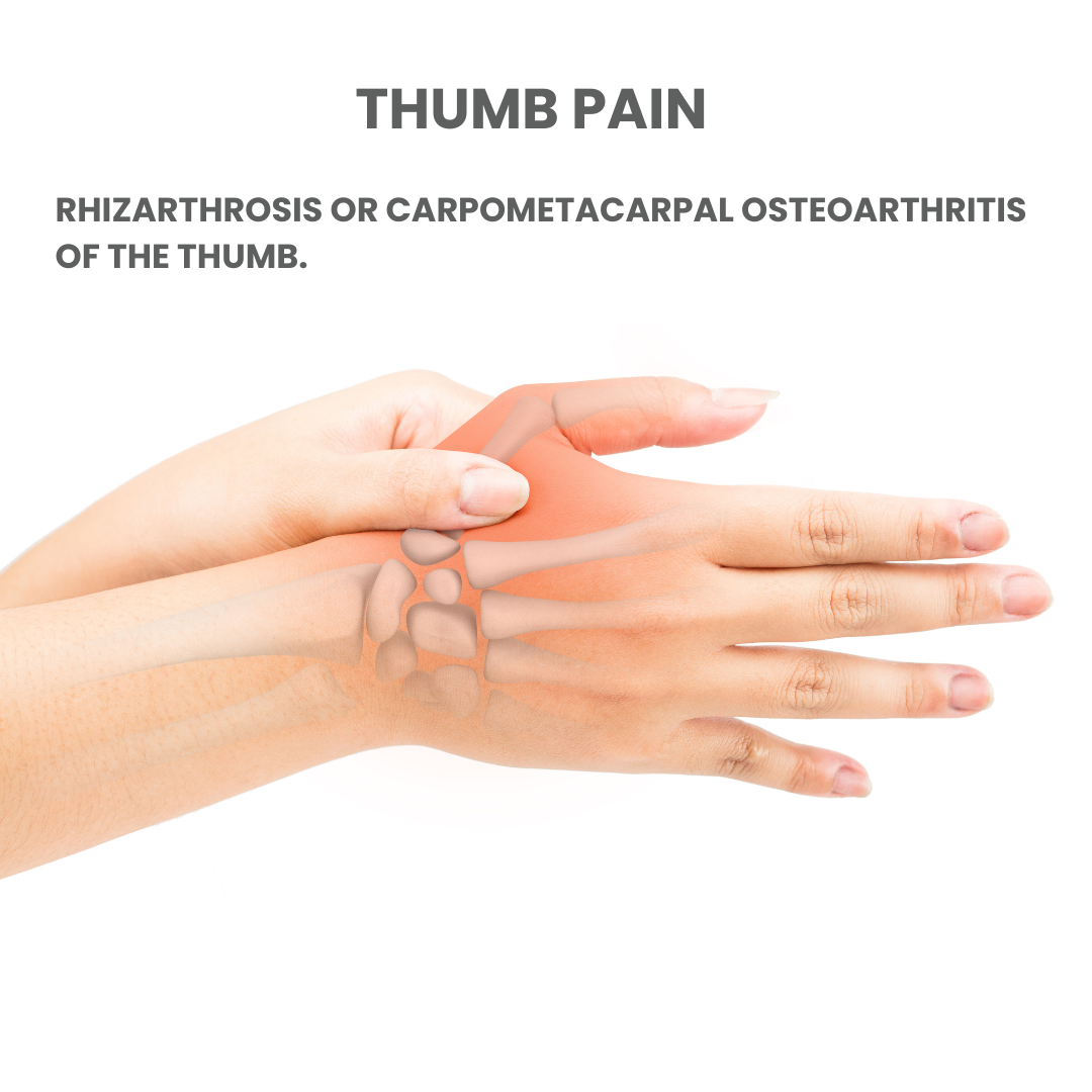 Ortesis para Pulgar RhizaLine REF: OPTS