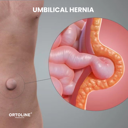 Umbilical Hernia Belt